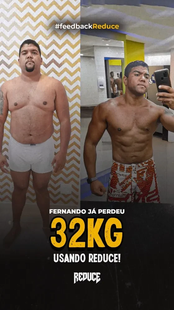 Fernando já perdeu 32 kg usando REDUCE